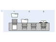 Assembly illustration for Threaded inserts for hot or ultrasound embedding without head, opposed helical knurl, for thermoplastics
